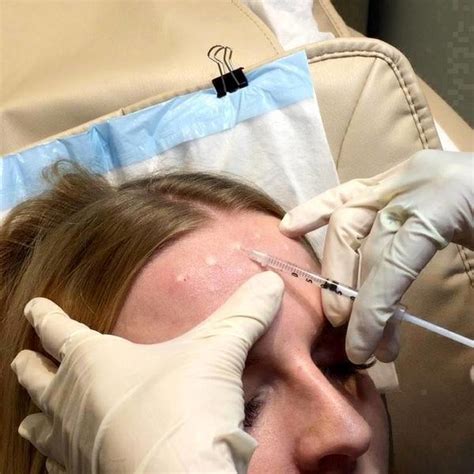 non surgical facelift las vegas